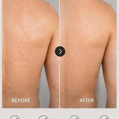 Swonston™ Japanese Exfoliating Body Towel